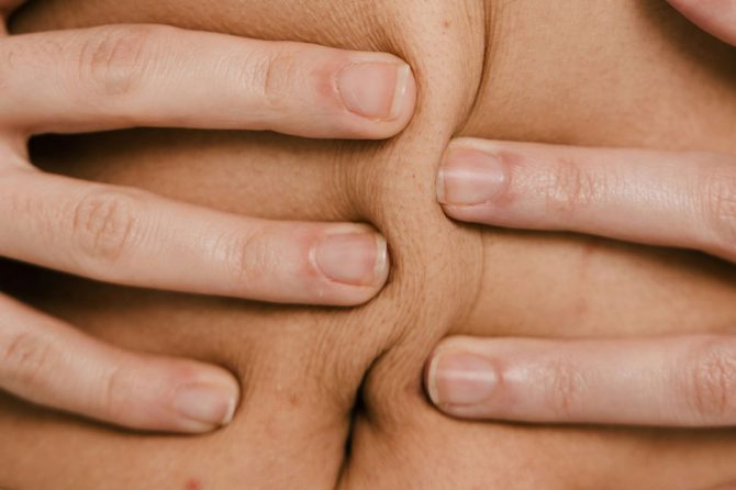 Què és la diàstasi abdominal?